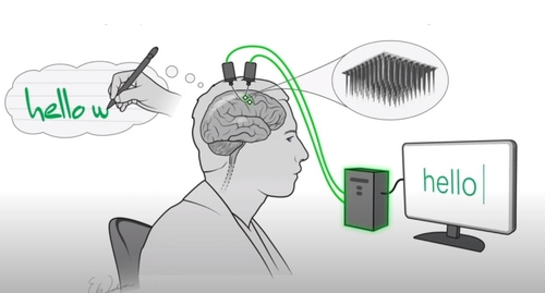 손글씨 BCI 개념도 (사진=F. Willett et al./Nature 2021/Erika Woodrum 제공/연합뉴스)